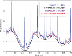That high amplitude noise is not what we call a wandering baseline (which is a slow shift in the dc level of the signal). Figure 5 From Low Power Real Time Ecg Baseline Wander Removal Hardware Implementation Semantic Scholar