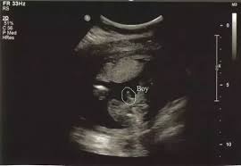 This will be performed between 18 and 20 weeks. How Do Doctors Identify The Sex Of The Baby During Ultrasound Quora