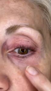 I'm shocked by the results of this cream