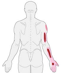 Pin On Reflexology