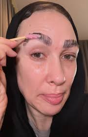 You definitely need a trim' people beg as woman shows off the true after  effects of having a eyebrow transplant