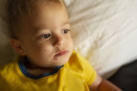 Image result for yellow scabs on the face in children