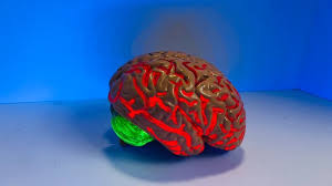 Amyotrophic lateral sclerosis (als), also known as motor neuron disease (mnd), lou gehrig's disease, and charcot's disease, is a progressive neurodegenerative disease that attacks motor neurons in the brain and spinal cord. Als Finding Links Blood And Brain Technology Networks