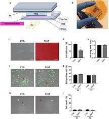 Check spelling or type a new query. Colour Sensitive Conjugated Polymer Inkjet Printed Pixelated Artificial Retina Model Studied Via A Bio Hybrid Photovoltaic Device Scientific Reports
