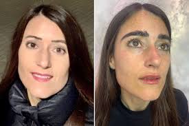 Feeling brow-beaten? Try a £7,000 transplant to get Cara's caterpillars