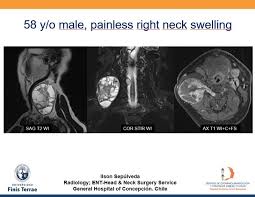 Check spelling or type a new query. Suzanne Shepherd M D Musculoskeletal Radiologist Teleradiologist Health Scan Imaging Temecula Valley Desert Cities Locations Ca Linkedin
