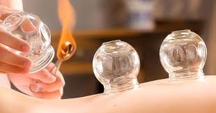 Road, andheri (w), mumbai 400058, mumbai, maharashtra 400053 09820066520. Cupping Benefits Fire Cupping Near Me Manhattan Wellness Family Chiropractor Near Me Acupuncture Near Me Lower Back Pain Neck Pain Shoulder Pain Knee Pain Sciatica Pain Pinched Nerve Herniated Disc Back