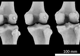The ribs that individually connect to the sternum. Tiny Knee Bone Once Lost In Humans Is Making A Comeback The Scientist Magazine