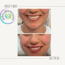 Blog Port St. Lucie, FL