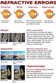 Image result for Refractive Error
