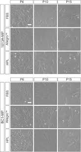 We did not find results for: Gmp Compatible And Xeno Free Cultivation Of Mesenchymal Progenitors Derived From Human Induced Pluripotent Stem Cells Stem Cell Research Therapy Full Text