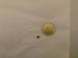 Bu hareketler böbrek taşının böbrek içerisinde bulunduğu yere göre değişecektir. Bobrek Tasi Nasil Duser Evde Dusurmek Mumkun Mu