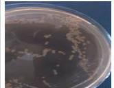 Characteristics of pathogenic Escherichia coli on Sorbitol ...