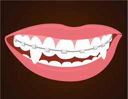 How to make vampire teeth. How To Make Vampire Fangs If You Have Braces 12 Steps