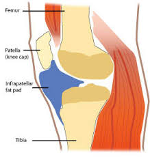 The healing process causes scar tissue to form. Physical Therapy For Knee Fat Pad Impingement Union Physical Therapy