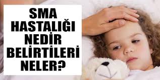 sma hastaligi kimlerde gorulur sma hastaligi nedir sma belirtileri nelerdir
