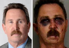 Injured Man Files Federal Lawsuit Against Lakeland Police