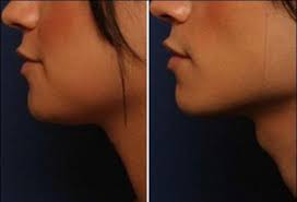 Di manakah halkum pada wanita?