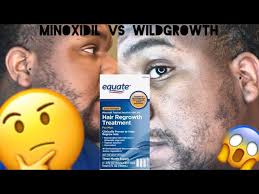 Equate Version Minoxidil Vs Wildgrowth Beard Growth 2020 Youtube