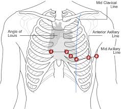 The rib cage is formed by bones and cartilages. Chest Leads Ecg Lead Placement Normal Function Of The Heart Cardiology Teaching Package Practice Learning Division Of Nursing The University Of Nottingham