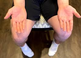 Image result for Cerebellar Function Test