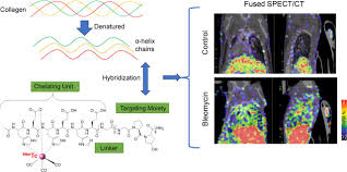 Collagen Hybridizing Peptide–Based Radiotracers for Molecular Imaging of  Collagen Turnover in Pulmonary Fibrosis | Journal of Nuclear Medicine