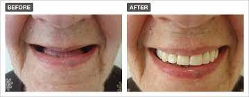 Maybe you would like to learn more about one of these? Dental Health Care