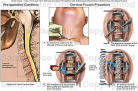 Pin On Nursing
