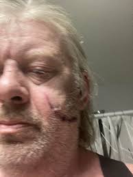 Cutting through a 220-volt line with cutters