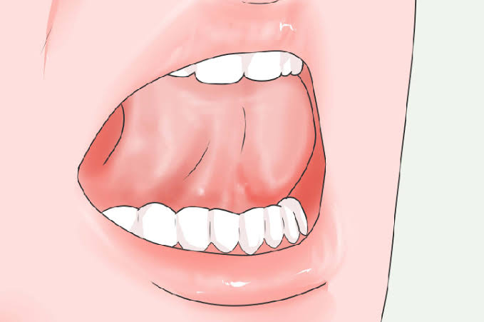 Hướng dẫn tư thế đúng của lưỡi khi tập Mewing - nha khoa Thùy Anh -  nhakhoathuyanh