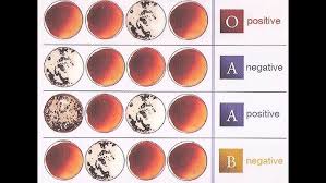 Image result for Blood Type