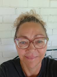 Wearing prosthetics is a personal choice