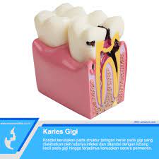 We did not find results for: Cara Meredakan Sakit Gigi Menggunakan Obat Paling Mujarab Berikut Ini