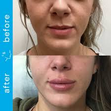 Meet Katie Winner, RN