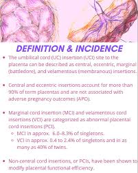Main outcome measures velamentous or marginal cord insertion. Vkfxhmdybzypam