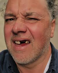 Dean Baldwin Lew (@deanbaldwinlew) • Instagram photos and videos