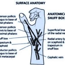Pdf Comparison Of Distal Transradial In The Anatomical Snuffbox Versus Conventional Transradial Access For Coronary Angiography And Intervention An Experience In 100 Cases The anatomical snuffbox is triangular deepening on the radial side of the wrist visible on extended thumb; pdf comparison of distal transradial