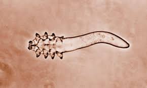 Image result for Demodex folliculorum
