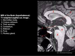 I checked today and his office says nothing yet. How Long Does It Take To Get Ct Scan Results How