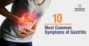 10 Most Common Symptoms Of Gastritis Gastritis Symptoms Back Pain Fatigue And Dizziness