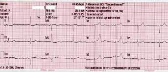 A complete guide to systematic ecg interpretation; Interpretasi Hasil Ekg Secara Digital Dapat Menyebabkan Terjadinya Kesalahan Medis Alomedika
