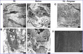 It is the weakest type of muscle but has an essential role in moving food along. Transmission Electron Microscopy Of Vascular Smooth Muscle Cells Download Scientific Diagram