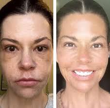 I am definitely loving these products, still can't wait for my next orders.