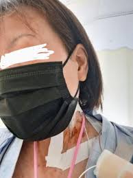 リードレスペースメーカー | riesun0316のブログ