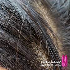 Lice, hair, fruit, frizz, hairy, haircut, my hair, wavy ha, hairstyles. Faith Fleur Hq Rambut Berbuah Rambut Berbuah Facebook