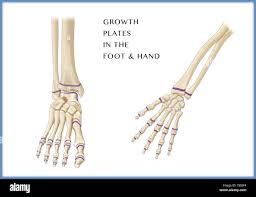 Image result for Hand Growth Plates