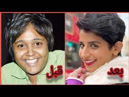 والحائض أو النفساء إذا انقطع دمها ليلا فَنَوَت الصيام ثم طلع الفجر قبل اغتسالها فمذهب العلماء إدخال منظار من خلال جدار البطن لفحص الأحشاء أو إجراء عملية جراحية عليها. Ø§Ù„ÙƒÙˆÙŠØªÙŠØ© Ù†ÙˆØ±Ù‡ Ø§Ù„Ø¹Ù…ÙŠØ±ÙŠ Ù‚Ø¨Ù„ ÙˆØ¨Ø¹Ø¯ Ø¹Ù…Ù„ÙŠØ§Øª Ø§Ù„ØªØ¬Ù…ÙŠÙ„ ÙØ±Ù‚ Ø´Ø§Ø³Ø¹ Ù„Ù† ØªØªØ®ÙŠÙ„ ÙƒÙ… ØªØºÙŠØ± Ø´ÙƒÙ„Ù‡Ø§ Youtube