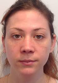 Semi Permenant Freckles and Beauty Marks by Pretty Permanent Make-up