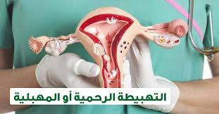 التهبيطة عند النساء ويب طب