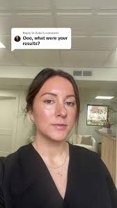 Replying to @Zuko microneedling might be the better option for me  #skinbetter #skinbettertechno #technoneckperfectingcream #skincare  #microneedling